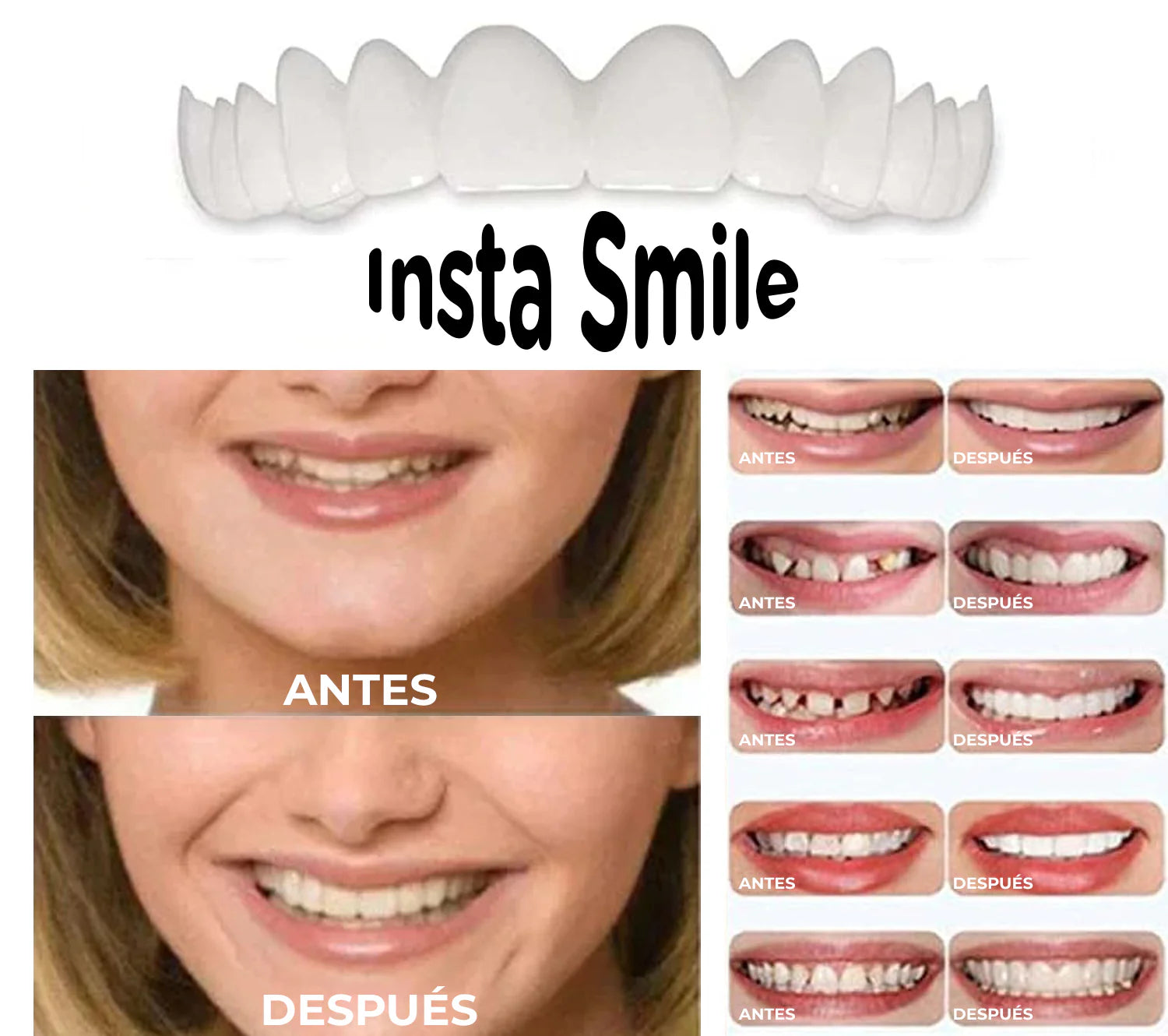 Carillas InstaSmile™ - Cubierta dientes